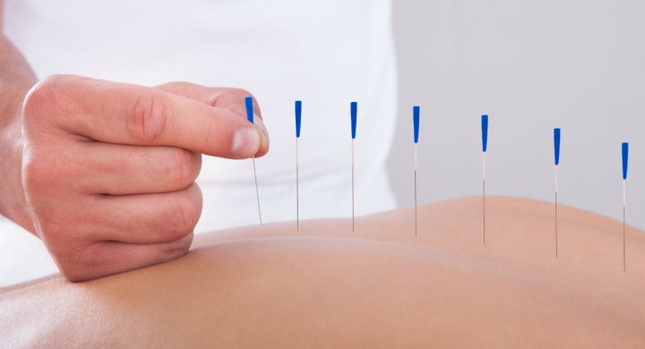 Pre-Birth Acupuncture Package January Offer