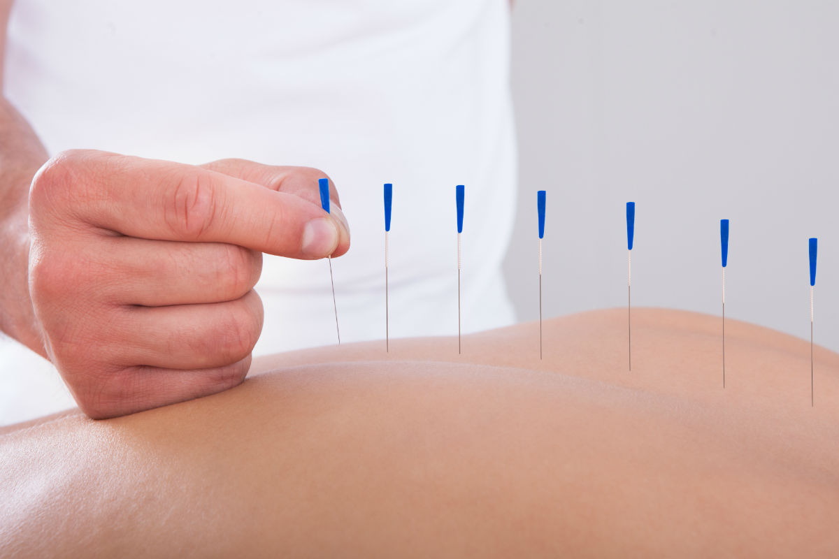 Pre-Birth Acupuncture Package January Offer