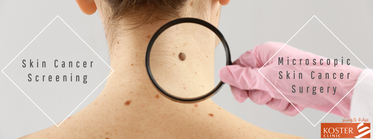 skin cancer screening dubai